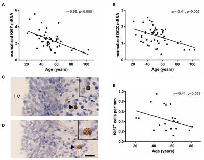 Decline in Proliferation and Immature Neuron Markers in the Human Subependymal Zone during Aging: Relationship to EGF- and FGF-Related Transcripts